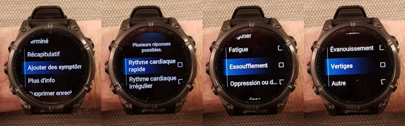 Symptmes fibrillation atriale