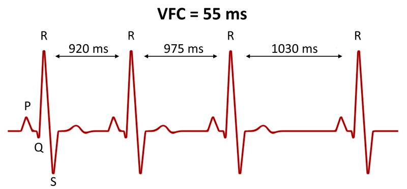 Tout savoir sur la mesure de variabilité de fréquence cardiaque