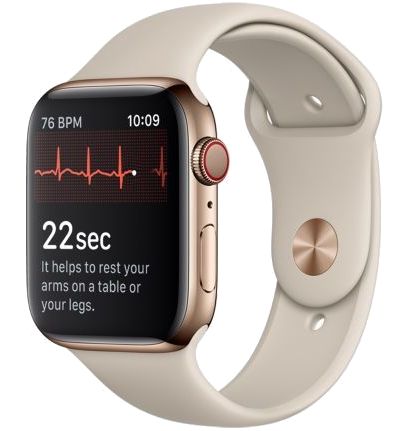 Electrocardiogram displayed on the Apple Watch