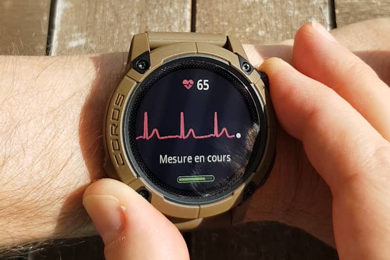 ECG